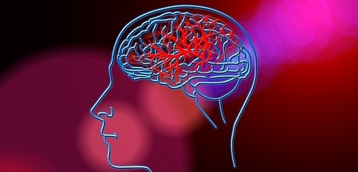 Hluboká mozková stimulace, obecně užívána k léčbě Parkinsonovy choroby, pomohla pacientce od depresí a nadváhy (ilustrační foto).
