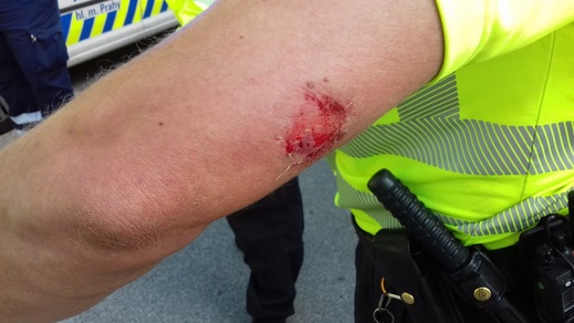 Zranění strážníka po útoku agresivní pejskařky.