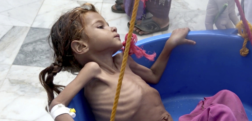 Situace v Jemenu se zhoršuje, hladomor hrozí až 14 milionům Jemenců.