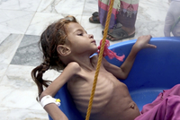 Situace v Jemenu se zhoršuje, hladomor hrozí až 14 milionům Jemenců.