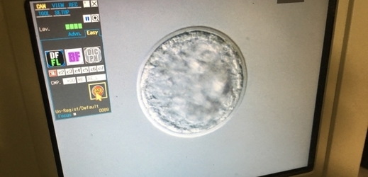 Na snímku ze 4. září 2019 je na obrazovce detail embryonálního stadia blatocysty.