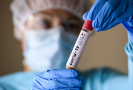 Koronavirus již není identifikován jako globální stav nouze, říká WHO 
