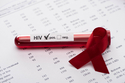 Rusko zaznamenalo narůst v počtu lidí nakažených virem HIV, během půl roku přibylo 30 000 případů