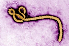 Ebola, jeden z největších zabijáků mezi známými viry.