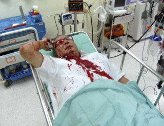Zraněný Limchtongui po převozu do nemocnice.