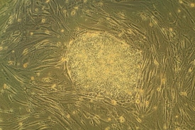Kolonie embryonálních kmenových buněk.