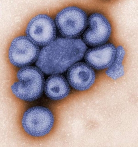 Smrtící vir typu A/H1N1.