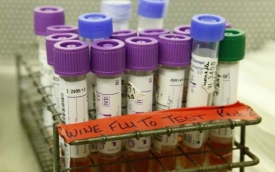 Zdravotníci proti mexické chřipce slibují účinné očkování.