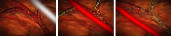 Mikrobublinky v krevní kapiráře prasknou působením ultrazvuku.