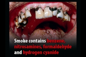 Kouřením pro hezký úsměv. Varovný obrázek od Evropské komise.