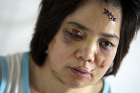 Ujgury páchané násilí na Chanech oficiální média zhusta ukazují.