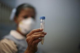 Na podzim bude chřipková epidemie opět aktuální.