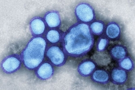 Nový virus chřipky A(H1N1).