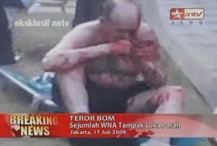 Jeden ze zraněných při bombovém atentátu na hotely v Jakartě.