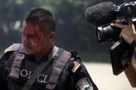 Zraněný voják po protestech zelayovců v El Paraiso.
