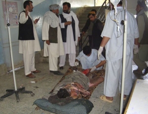 Jeden z popálených Afghánců v kundúzské nemocnici.