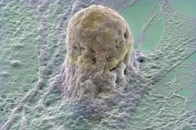 V USA se uvolnily pravidla pro výzkum kmenových buněk.