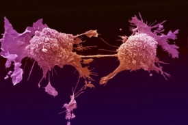 Dělící se buňky rakoviny plic.