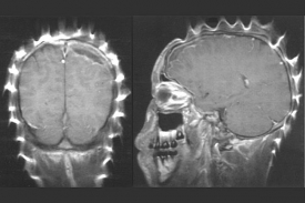 Oxid železa použitý jako pigment v tužidle na vlasy v MRI jasně svítí.