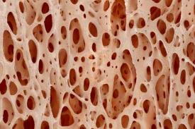 Upravený ratan je stejně pevný a přitom porézní jako kost (na obr.).