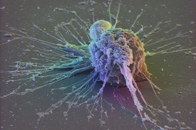 Kmenové buňky přestavují velkou naději moderní medicíny.
