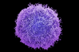 Rakovinná buňka je v mikroskopu krásná, ale je to krása, která zabíjí.