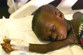 Jedna z dětských obětí nemoci AIDS v Africe