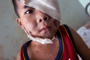 Šestiletý Laosan Konglan La narazil na nevybuchlou munici u domova.