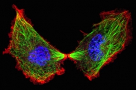 Dělení buňky zachycené fluorescenčním mikroskopem.