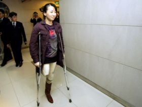 Ťin přišla o nohu v osmi letech.