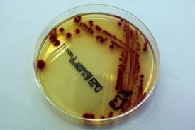 Bakterie Escherichia Coli