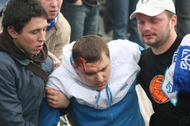 Ilustrační foto. Snímek je z bitky fotbalových fanoušků v Kyjevě.