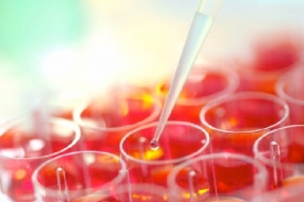 Čeští vědci úspěšně nahrazují kmenové buňky.