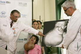 Doktor Robert Marx ukazuje na CT obraz dívčina obličeje.