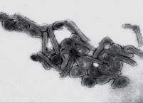 Virus marburg pod mikroskopem.