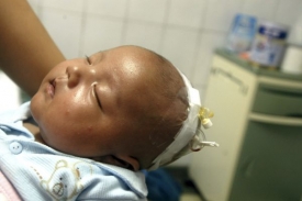 Jedno z nemocných dětí. opět aféra se závadnými potravinami v Číně.  