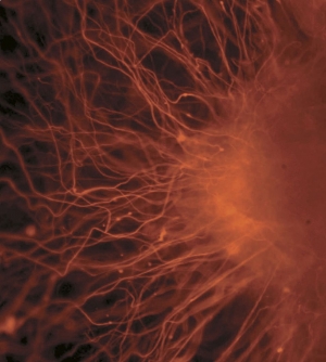 Cíl vědců - funkční nervové buňky vyrostlé z kmenových buněk.
