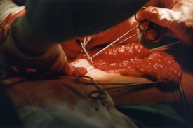 Plastická chirurgie nejsou jen kosmetické úpravy. Ilustrační foto.