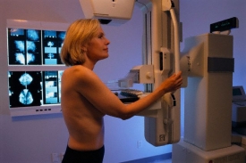 Vyšetření mamografem.