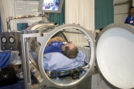 Jednomístná hyperbarická komora. Ilustrační foto.