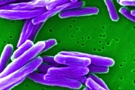 Původce tuberkulózy, bakterie Mycobacterium tuberculosis.